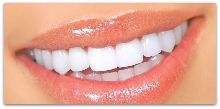 6 Tips Putihkan Gigi Yang Kuning